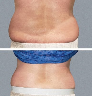 2_fat_reductions